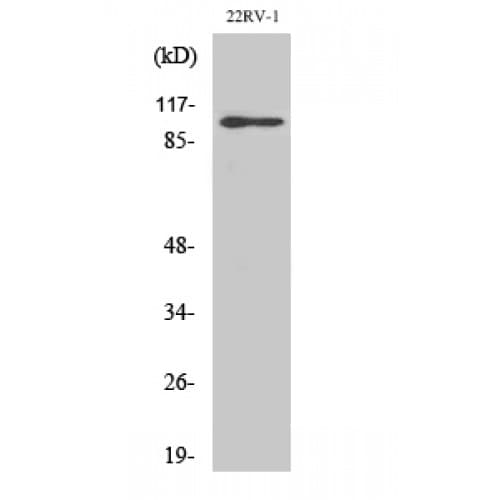 GRIA2 / GLUR2 Antibody (820-900 aa)