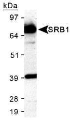 SCARB1 / SR-BI Antibody (Biotin)