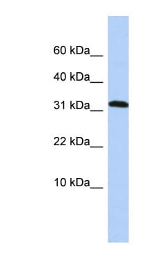 PPP1R27 / DYSFIP1 Antibody (aa36-85)