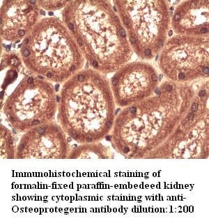 OPG / Osteoprotegerin Antibody
