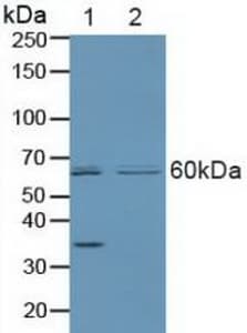 PARK2 / Parkin 2 Antibody (aa229-465, APC)