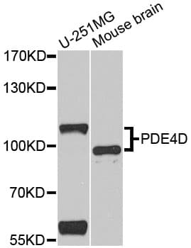 Polyclonal Rabbit anti-Human PDE4D Antibody (IHC, WB)