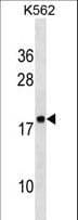 IHC-plus™ Polyclonal Rabbit anti-Human RPLP2 Antibody (aa13-41, IHC, WB)