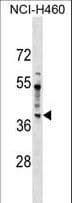 Polyclonal Rabbit anti-Human SDCCAG8 Antibody (aa188-215, WB)