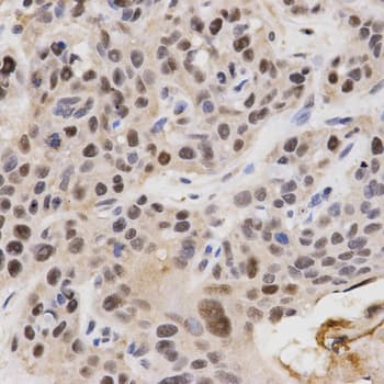 QIP1 / KPNA4 Antibody