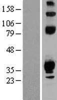 TEPP Protein (Over-Expression Lysate Myc-DDK (Flag))