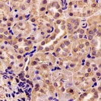 AK4 / Adenylate Kinase 4 Antibody