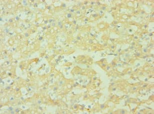 CD38 Antibody (aa46-300)