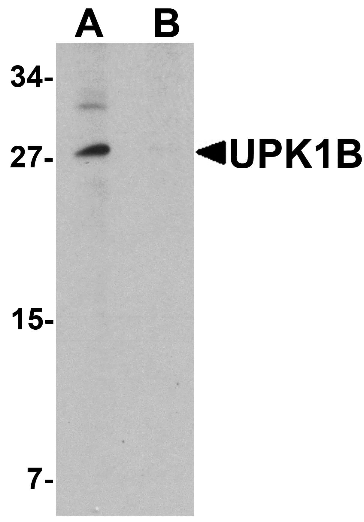TSPAN20 / UPK1B Antibody