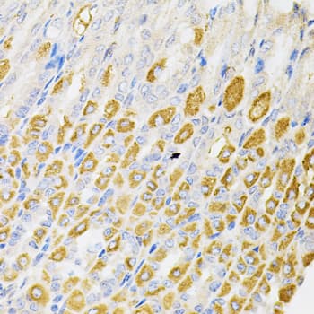 RPS6KA3 / RSK2 Antibody