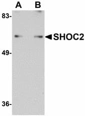 Polyclonal Rabbit anti-Human SHOC2 Antibody (IHC, WB)