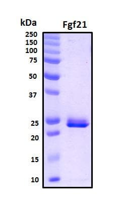 Mouse FGF21 Protein (Recombinant His, N-Terminal)