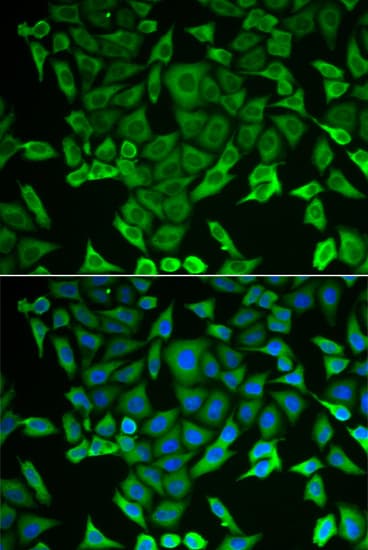 Polyclonal Rabbit anti-Human RARS Antibody (IHC, IF, WB)