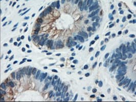KRT18 / CK18 / Cytokeratin 18 Antibody (clone OTI1E1)