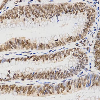 Polyclonal Rabbit anti-Human Histone H3 Antibody (IHC, IF, WB)