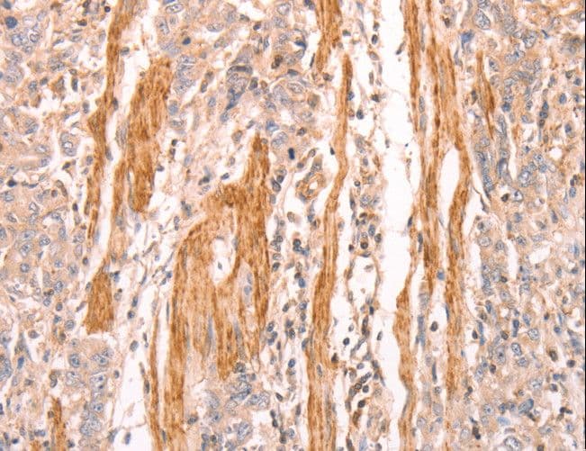 INA / Alpha Internexin Antibody