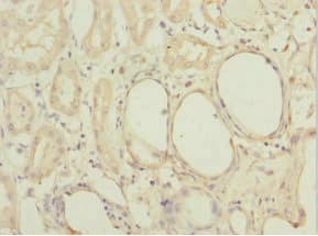 MGLL / Monoacylglycerol Lipase Antibody