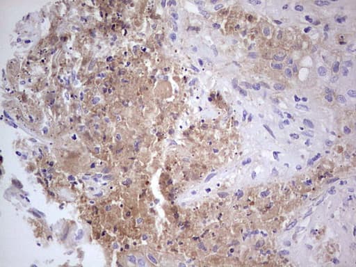 Monoclonal Mouse anti-Human CFI / Complement Factor I Antibody (clone OTI15E11, Carrier-free, aa340-583, IHC, WB)
