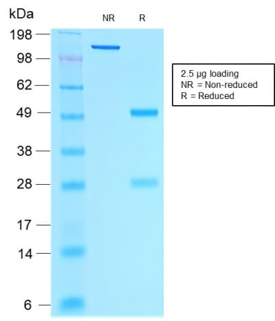 ER Alpha / Estrogen Receptor Antibody (clone rESR1/1935)
