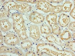 Polyclonal Rabbit anti-Human AKAP8L Antibody (aa1-240, IHC)