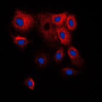 CYP2B6 Antibody (Internal)