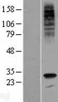 SCN4 / G6PC3 Protein (Over-Expression Lysate Myc-DDK (Flag))