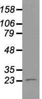Monoclonal Mouse anti-Human NEUROG1 / NGN1 / Neurogenin 1 Antibody (clone OTI8G8, IF, WB)