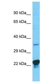GNB3 Antibody (aa268-317)