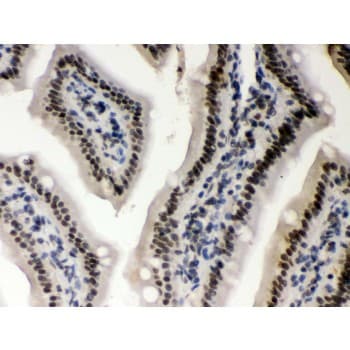 CSNK1A1 / CK1 Alpha Antibody (aa30-68)