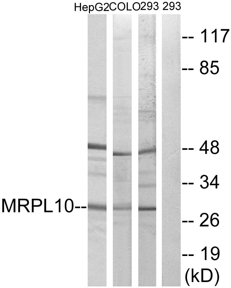 MRPL10 Antibody (aa211-260)