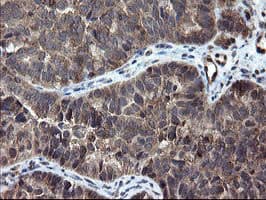 SKIL / SNO / SnoN Antibody (clone OTI3E9)
