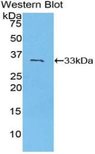 P2RY14 / GPR105 Antibody (aa51-303)