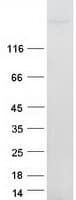 Human ITGB4 / Integrin Beta 4 Protein (Recombinant Myc-DDK (Flag))