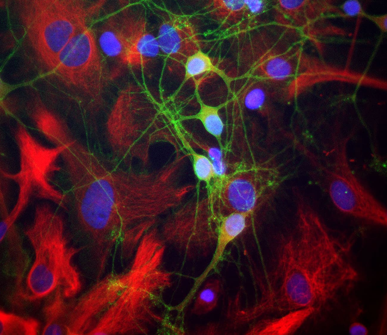 IHC-plus™ Polyclonal Rabbit anti-Human SPTAN1 / Alpha Fodrin Antibody (IHC, IF, WB)