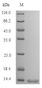 Human SFTA3 Protein (Recombinant 6His, N-terminus)
