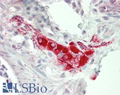 IHC-plus™ Polyclonal Rabbit anti-Human GSK3B / GSK3 Beta Antibody (aa1-50, IHC, WB)