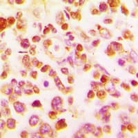 Polyclonal Rabbit anti-Human BCL6 Antibody (C-Terminus, IHC, WB)