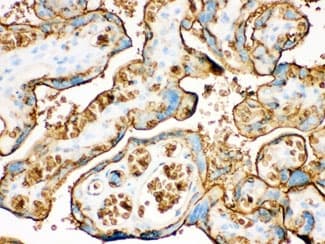 SLC2A1 / GLUT-1 Antibody (aa92-492)