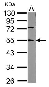 TUBA1A / Tubulin Alpha 1a Antibody (aa37-276)