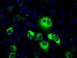 TS / Thromboxane Synthase Antibody (clone OTI2C1)