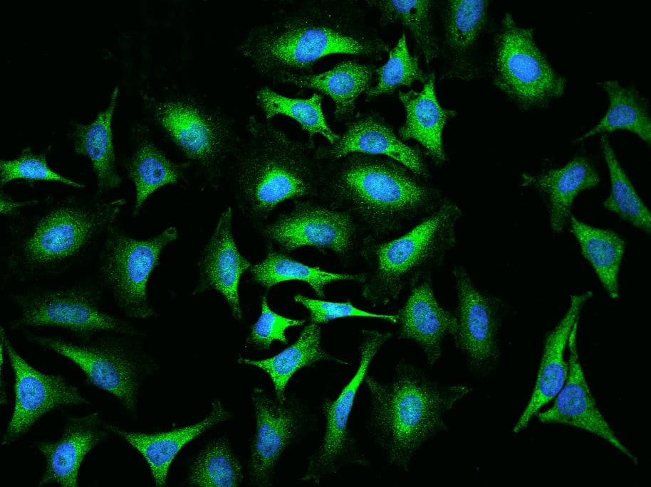 Polyclonal Rabbit anti-Human ABCF2 Antibody (Preservative Free, IF, WB)