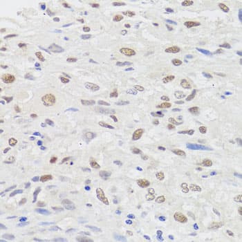 Polyclonal Rabbit anti-Human HMGN1 / HMG14 Antibody (IHC, WB)