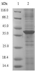 Human AHSP / EDRF Protein (Recombinant GST, N-terminus)