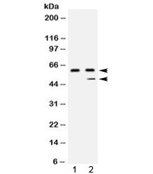 Polyclonal Rabbit anti-Human CPB2 / TAFI Antibody (IHC, WB)