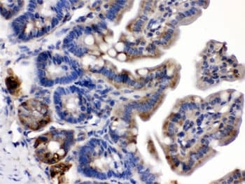 TLN2 / Talin 2 Antibody