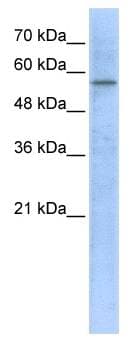 HMGCS1 / HMG-CoA Synthase 1 Antibody (aa251-300)