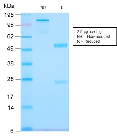 Recombinant Monoclonal Rabbit anti-Human TNC / Tenascin C Antibody (clone TNC/2981R, IHC)
