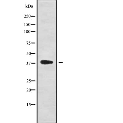 NKX6-1 Antibody