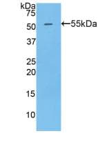 Mouse GOLM1 / GP73 / GOLPH2 Protein (Recombinant His-GST, N-terminus)