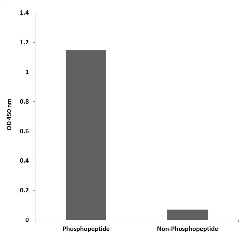 IGF1R / IGF1 Receptor Antibody (phospho-Tyr980)
